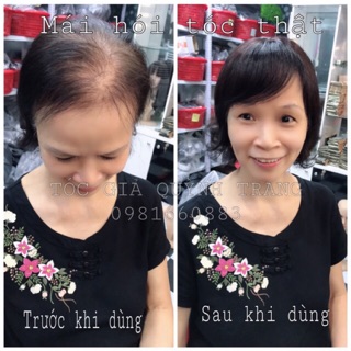 Siêu phẩm mái che hói, Che tóc bạc (tóc thật 100% uốn nhuộm ép)