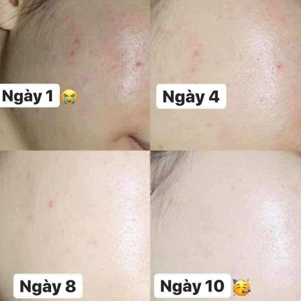 SERUM DƯỠNG TRẮNG GIẢM THÂM DA BALANCE VITAMIN C