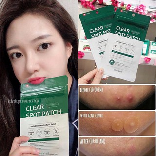 MIẾNG DÁN MỤN SOME BY MI Clear Spot Patch