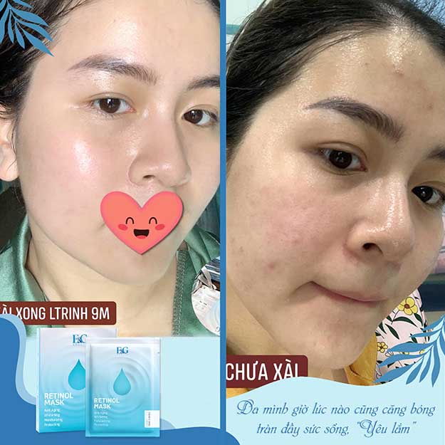 Mặt nạ tái tạo giúp trắng sáng, căng bóng và chống lão hóa Retinol Mask E&amp;G Beauty 25g (Hộp 3 Miếng) | Wings Shop