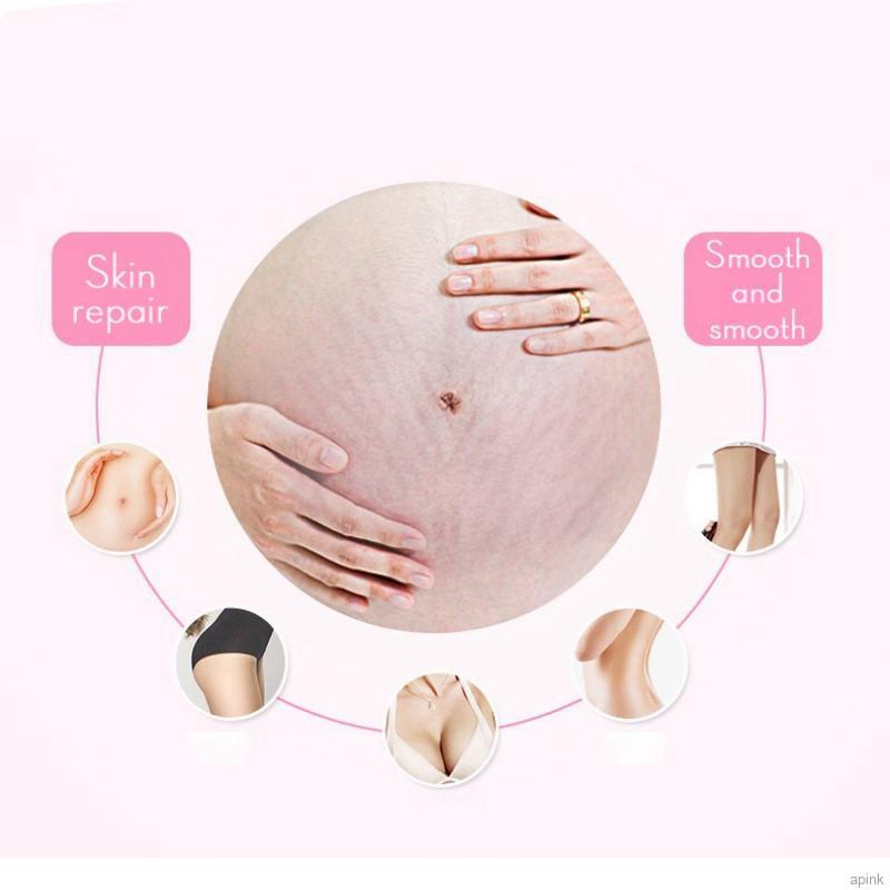 [Hàng mới về] Kem hỗ trợ giảm rạn da sau sinh làm sáng da 6ml