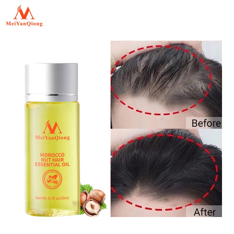 Tinh dầu kích thích mọc tóc MeiYanQiong chiết xuất hạt Ma Rốc chăm sóc hiệu quả giúp mọc tóc phục hồi tóc hư tổn giữ nếp tạo nếp tóc mềm 20ml