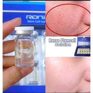 Tế Bào Gốc Ronas Stem Cell Solution ( 10 ống 1 hộp )