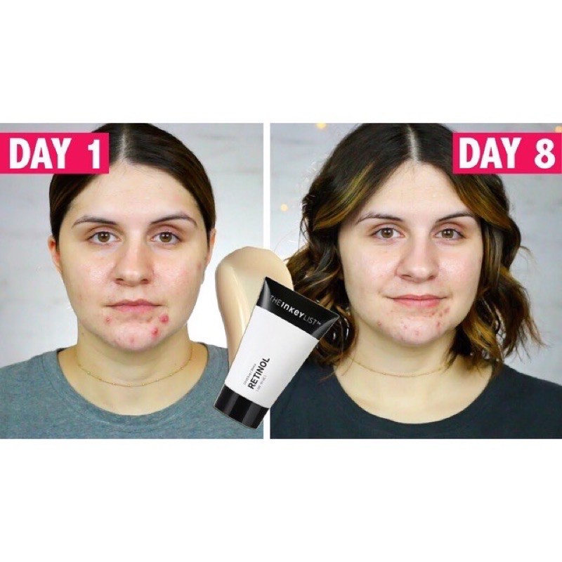 Serum giảm mụn, chống lão hoá retinol Inkey list 30ml