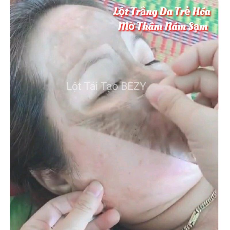 Lột Bong Da Mặt Trắng Da Nam Nữ Bezy