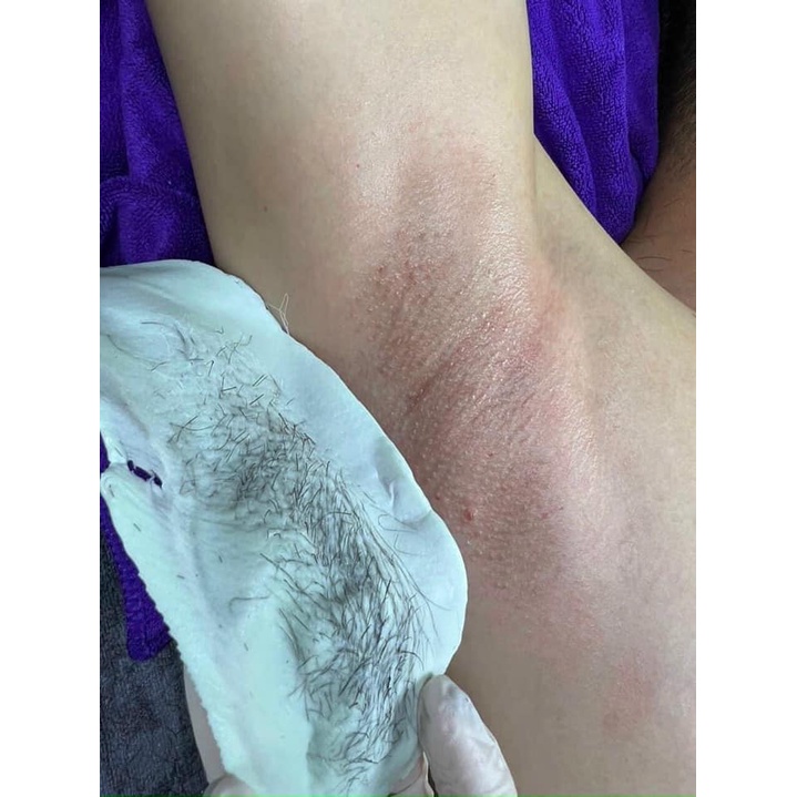 Combo wax lông nóng loại tốt giá rẻ&lt;Bát +Sáp +Que + Mỡ&gt; tẩy lông đơn giản nhất tại nhà