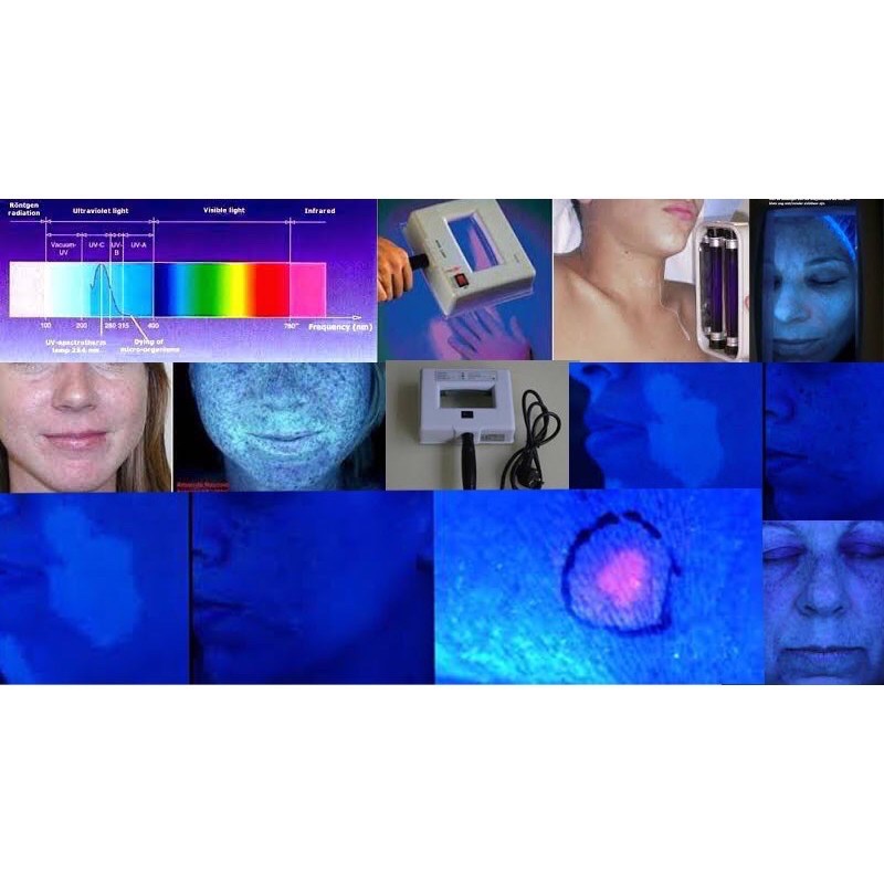 Đèn Wood soi da dành cho spa