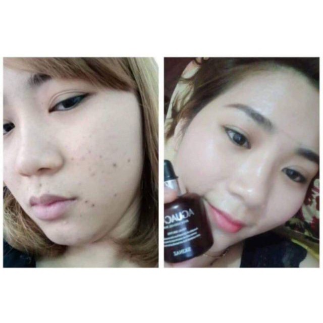 TINH CHẤT BƠ DƯỠNG DA KHỎE CĂNG BÓNG SÁNG HỒNG SKINAZ HÀN QUỐC