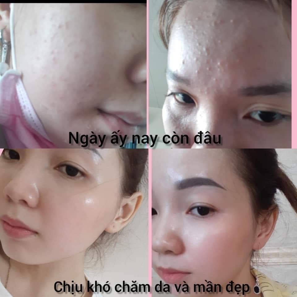 KEM VI GAI TẢO BIỂN VÀNG 24K RONAS PEEL KHÔNG BONG