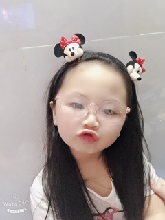 Cài tóc hình chuột Mickey 2 con QT (cái)