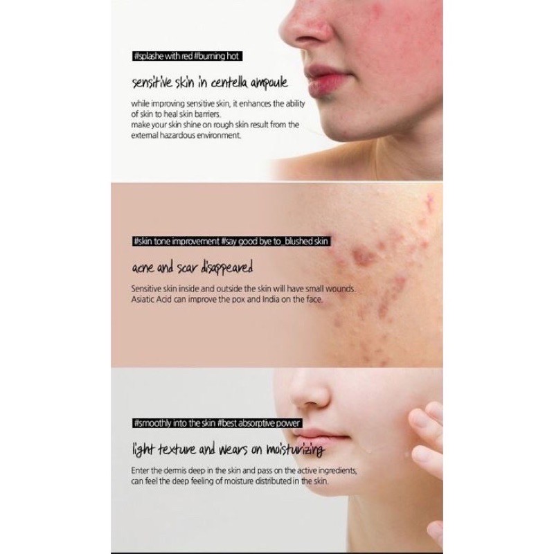 Tinh Chất Rau Má Hỗ Trợ Ngăn Ngừa Mụn, Phục Hồi Da Skin1004 Madagascar Centella Ampoule  Giá Sỉ