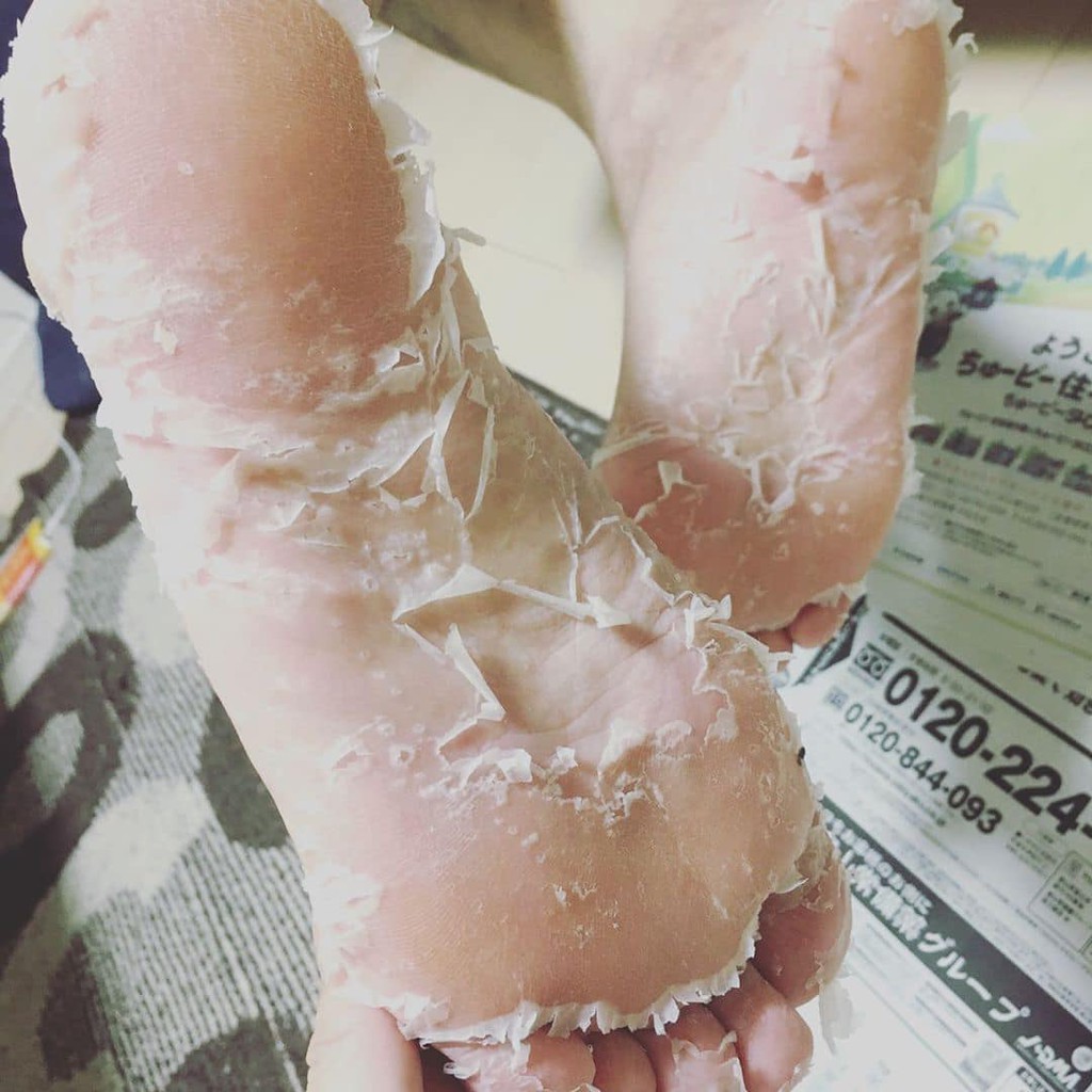 Túi Ủ Bong Da Chết Bàn Chân Mino Baby Foot Nhật Bản