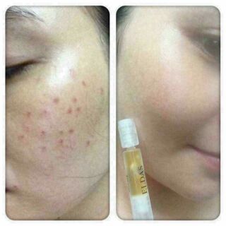 Set 4 ống serum tế bào gốc ELDAS EG tox program