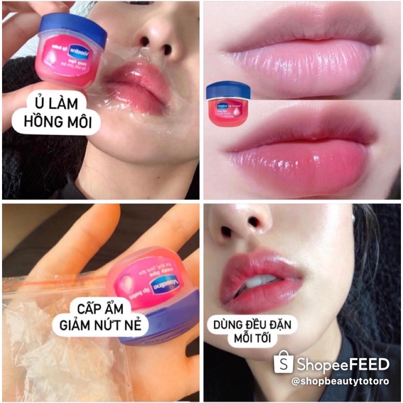 Vaseline Dưỡng Môi Hồng Lip Therapy Rosy 7g ANVISHOP