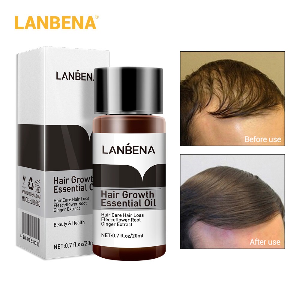 Set 3 tinh dầu kích thích mọc tóc Lanbena nuôi dưỡng chân tóc ngăn ngừa hói đầu hiệu quả 20ml