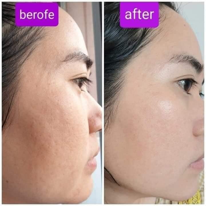 [CHÍNH HÃNG] Serum Saffron Vitamin B5 Chính Hãng, Công Dụng 3 In 1, Trẻ Hoá, Dưỡng Da, Ngăn Ngừa Lão Hoá | BigBuy360 - bigbuy360.vn