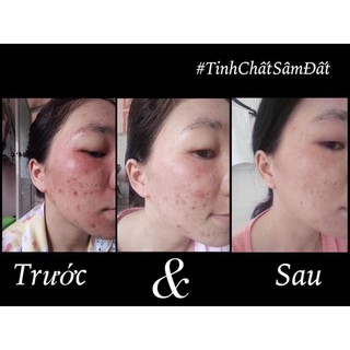 Tinh Chất Sâm Đất - Thảo Mộc Hàn