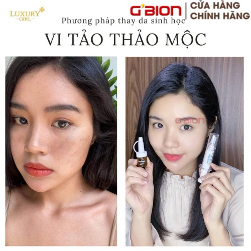 COMBO PEEL DA VI TẢO THẢO MỘC LUXURY GIRL, NPP GBION