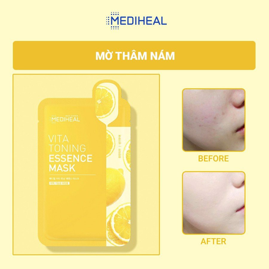 Mặt nạ dưỡng ẩm, làm trắng, ngăn ngừa lão hóa cao cấp Mediheal mẫu mới 20ml