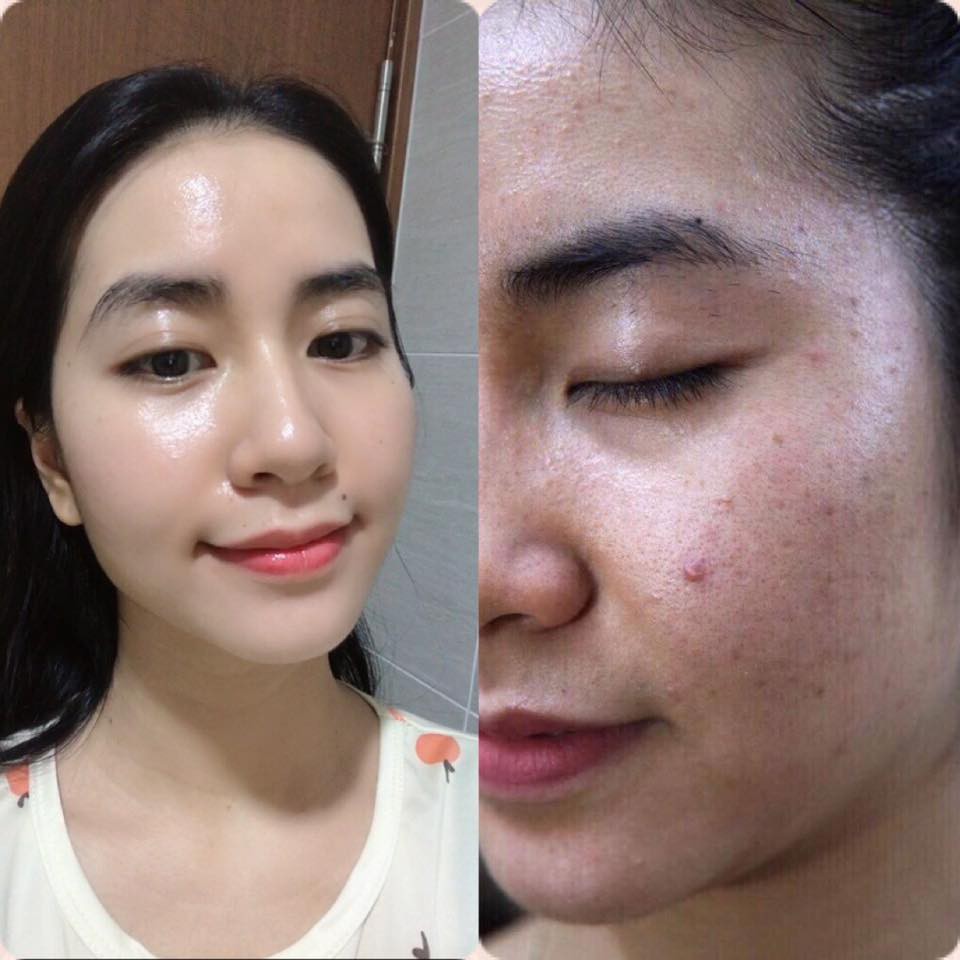 Xịt dưỡng serum Tế bào gốc Mioskin 5 in 1 | BigBuy360 - bigbuy360.vn