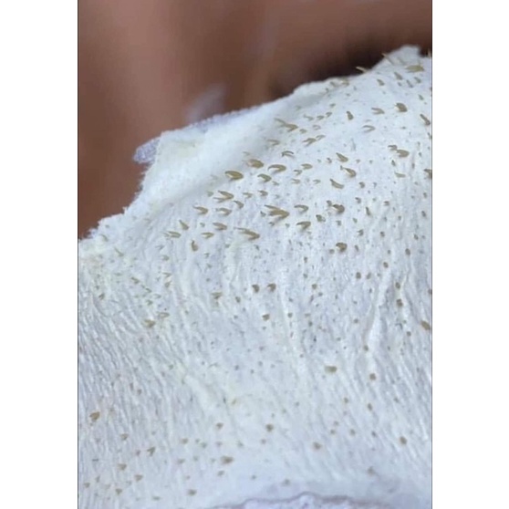 GEL LỘT MỤN HANDMADE