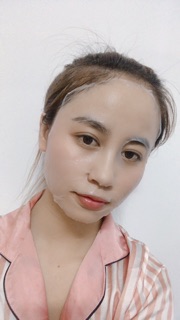 Mặt nạ nhau thai