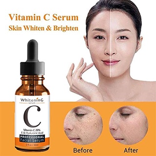 Serum Whitening C 30ml-Tinh chất chống lão hóa căng bóng da