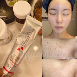 Kem Nám Melasma X 3D Whitening Clinic