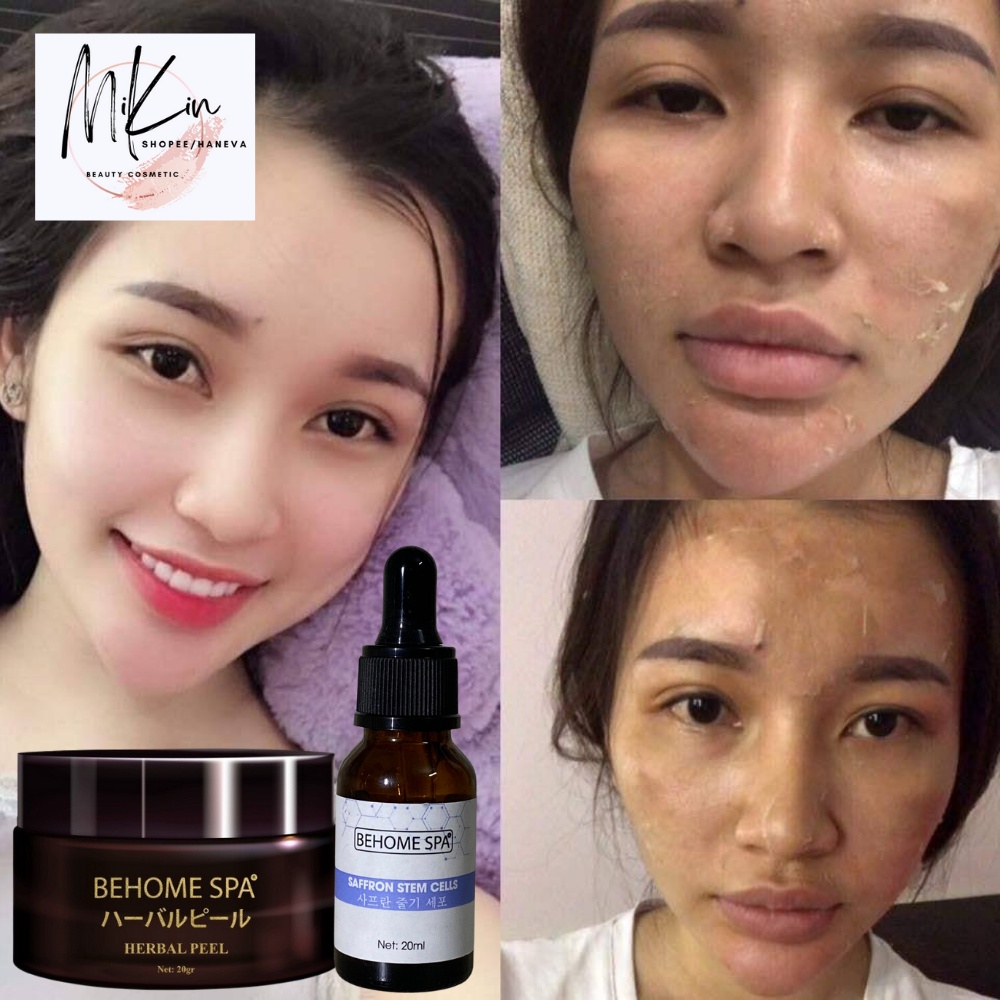 Thay Da Sinh Học HERBAL PEEL - BEHOMESPA Công Nghệ Nhật Bản