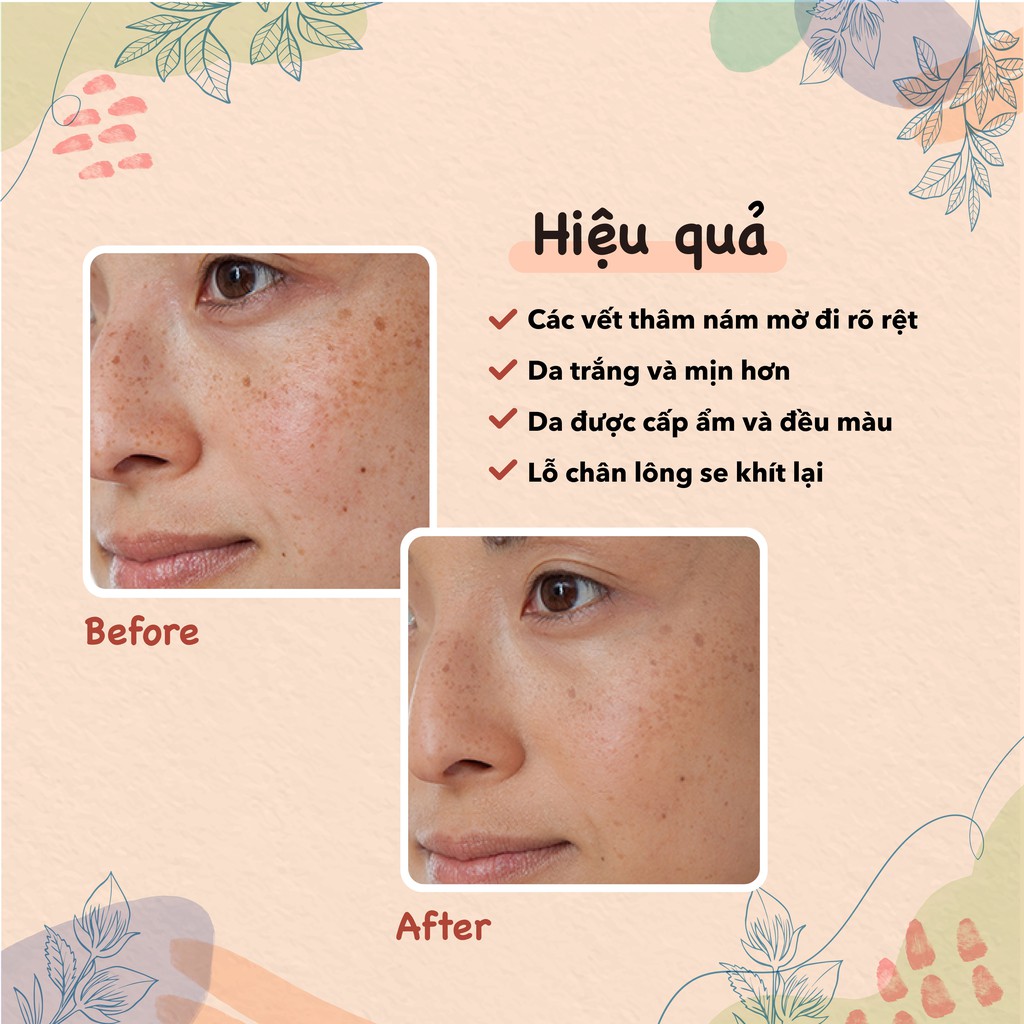 Serum tái tạo phục hồi chuyên sâu Themis Melasma Renew Serum 30ml | BigBuy360 - bigbuy360.vn