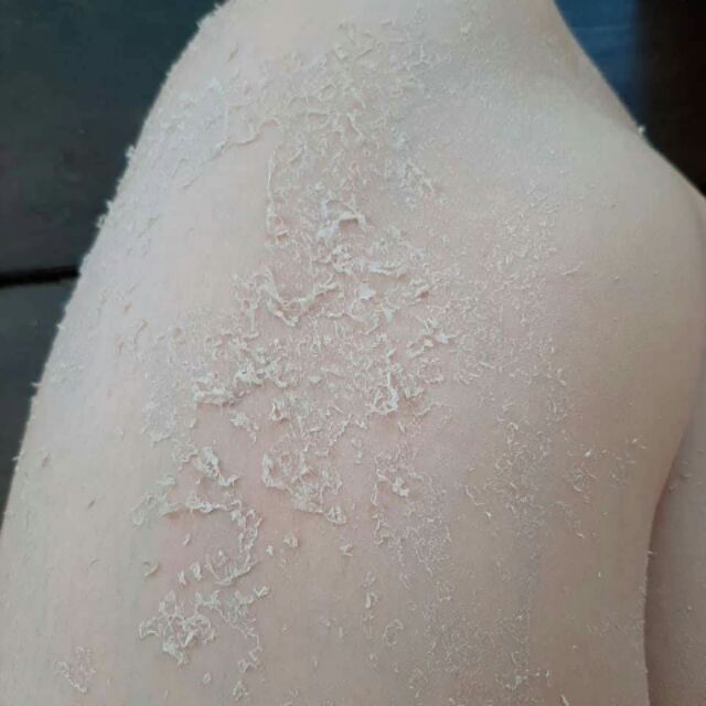 Kem tái tạo bong da body