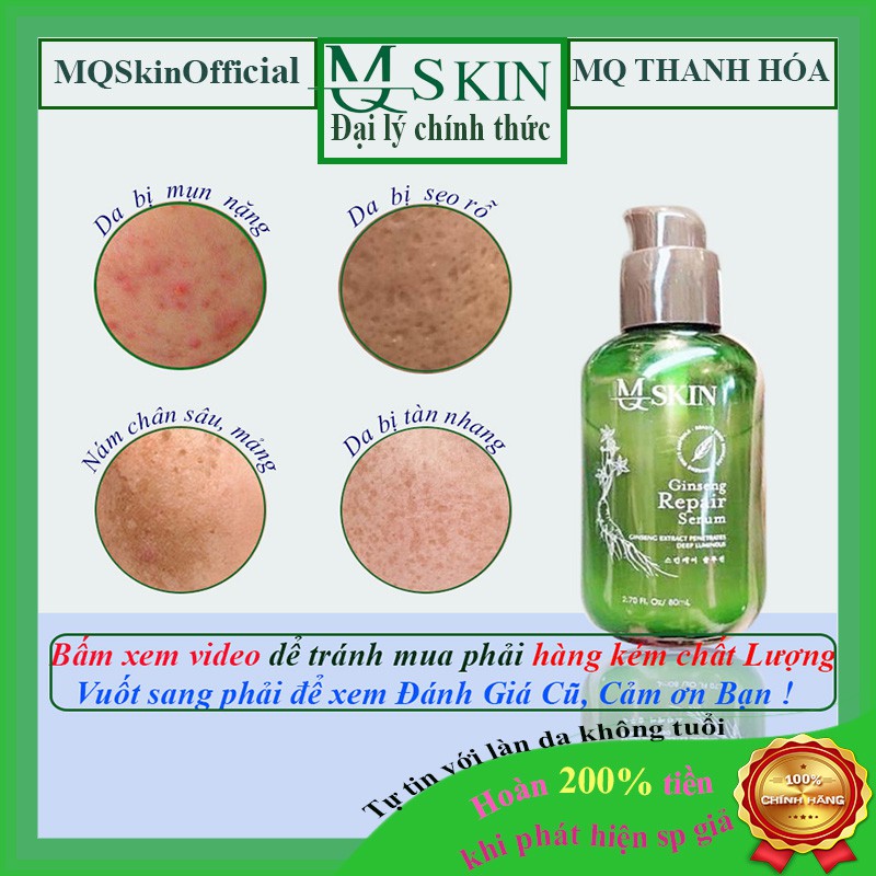 Mq Skin Chính Hãng Thay Da Nhân Sâm MQ Skin Tái Tạo Da Nhân Sâm Mq skin