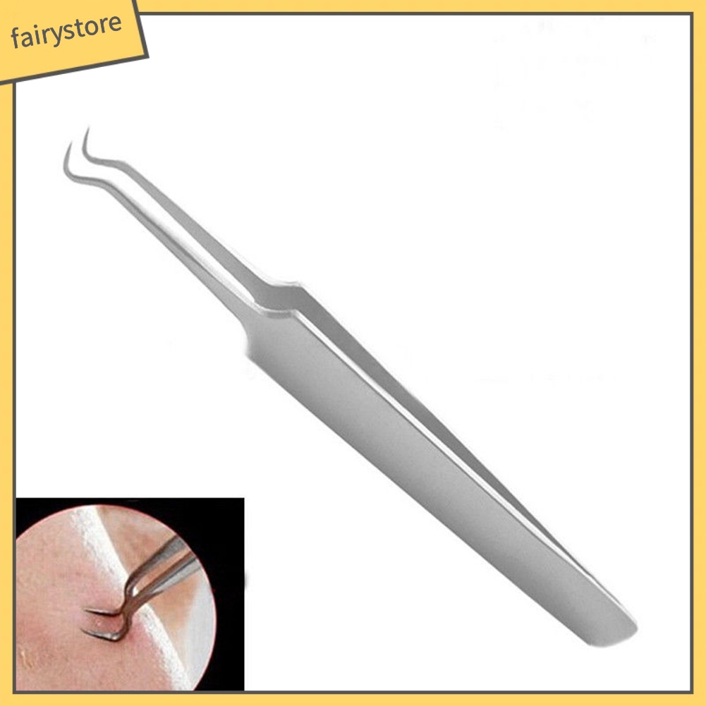 Nhíp lấy nhân mụn đầu đen tiện dụng