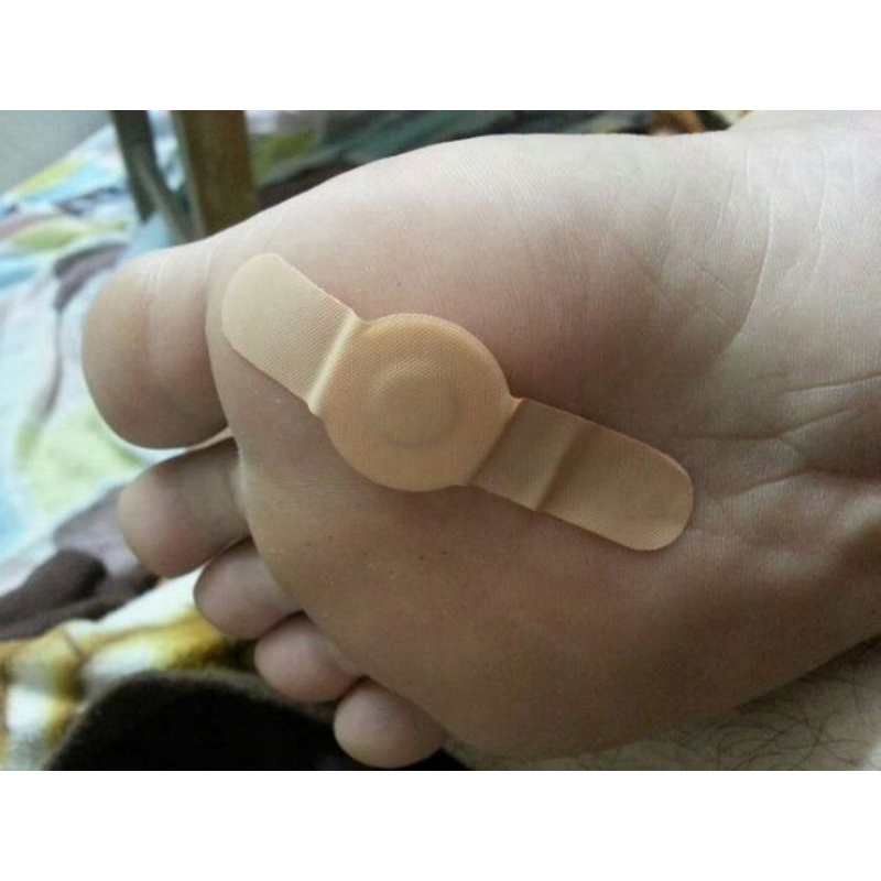 Miếng dán mụn cóc