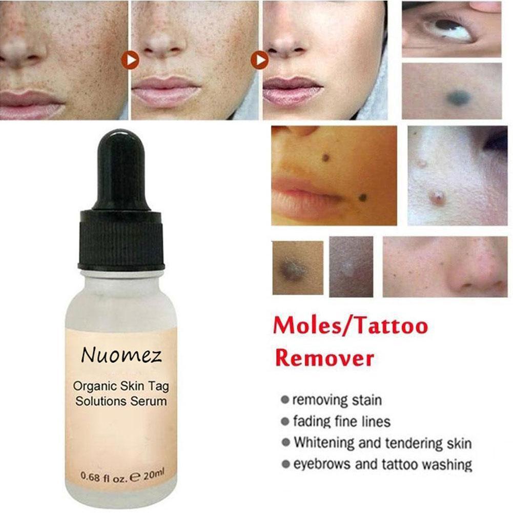 [Hàng mới về] Kem xóa nốt ruồi/ tàn nhang không đau G3R7 Y8R2 C5F1