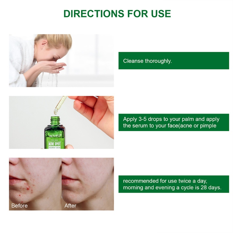 XIXI Serum Hỗ Trợ Giảm Mụn Chiết Xuất Tràm Trà Làm Sạch Da Hiệu Quả
 | BigBuy360 - bigbuy360.vn