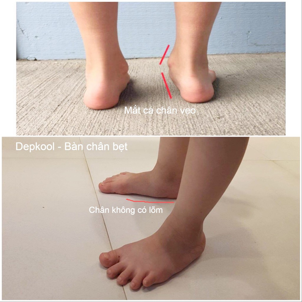 Giày hỗ trợ Bàn Chân Bẹt - Bé gái & người lớn | BigBuy360 - bigbuy360.vn