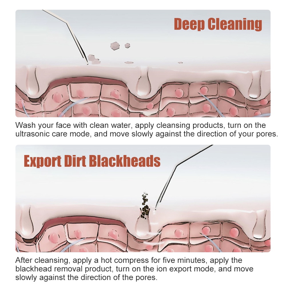 Máy Tẩy Tế Bào Chết Làm Sạch Sâu Lỗ Chân Lông Bằng Sóng Siêu Âm