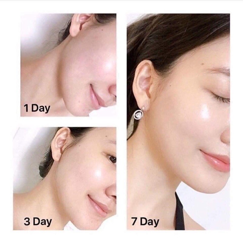 Tinh chất Lancome trẻ hoá da 7ml Fullbox