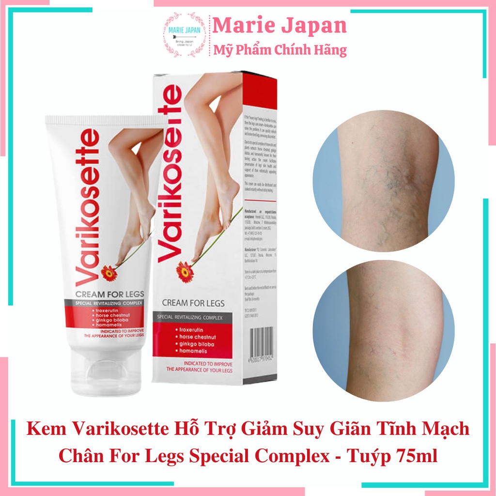 Kem Varikosette Hỗ Trợ Giảm Suy Giãn Tĩnh Mạch Chân For Legs Special Complex - Tuýp 75ml | BigBuy360 - bigbuy360.vn