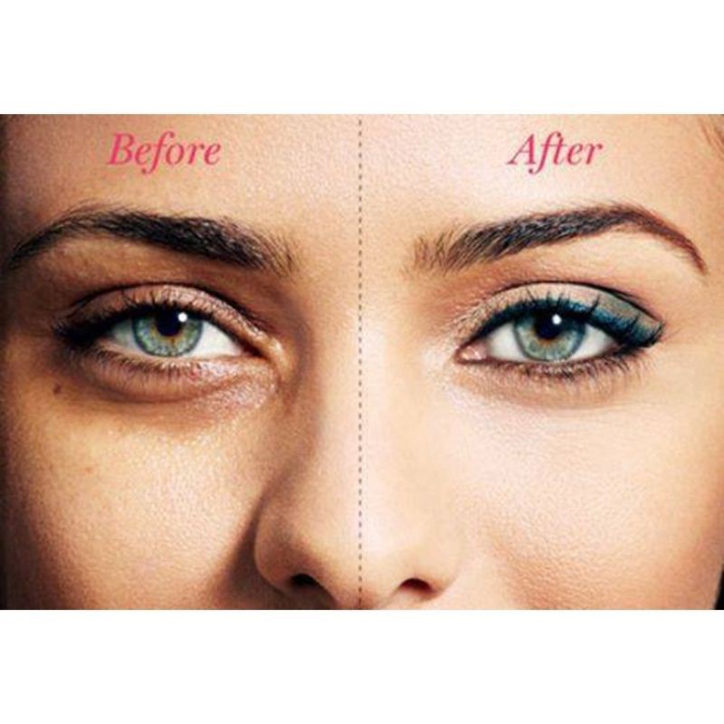 Kem chống thâm vùng, quầng mắt Naris Wrinkle Plus Alpha Eye Zone Bright 20g