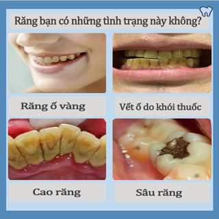 Hiệu quả 100% Kem Đánh Răng Làm Trắng Răng 250g Giảm Vết Ố Vàng Trên Răng