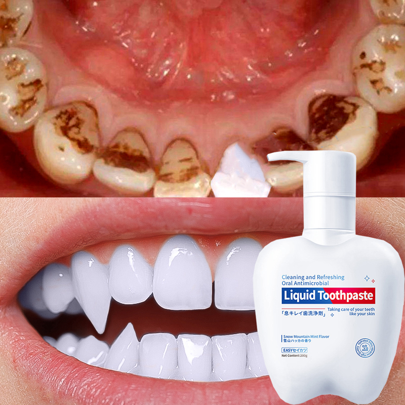 ⚡Hiệu quả 100%⚡Kem Đánh Răng Làm Trắng Răng 250g Giảm Vết Ố Vàng Trên Răng giảm sâu răng Giữ Hơi Thở Thơm Mát