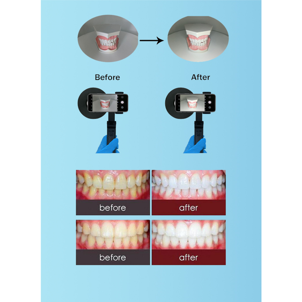 Đèn Led Nha Khoa 5W Chuyên Dụng Cho Nha Khoa
