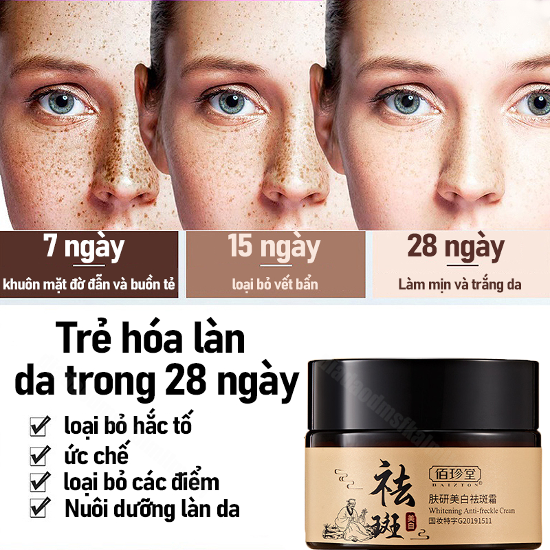 👍🏻Chính Hãng👍🏻 kem xóa nám làm trắng da tinh chất vitamin C kem dưỡng da mặt collagen Tinh chất sóc da làm mờ tàn nhang có hiệu quả 30g Hết tàn nhang nhanh trong 7 ngày