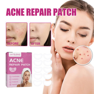 Miếng dán trị mụn Miếng dán trị mụn rõ ràng Miếng dán trị mụn Vô hình trong suốt thoáng khí Kem che khuyết điểm Làm sạch sửa chữa mụn