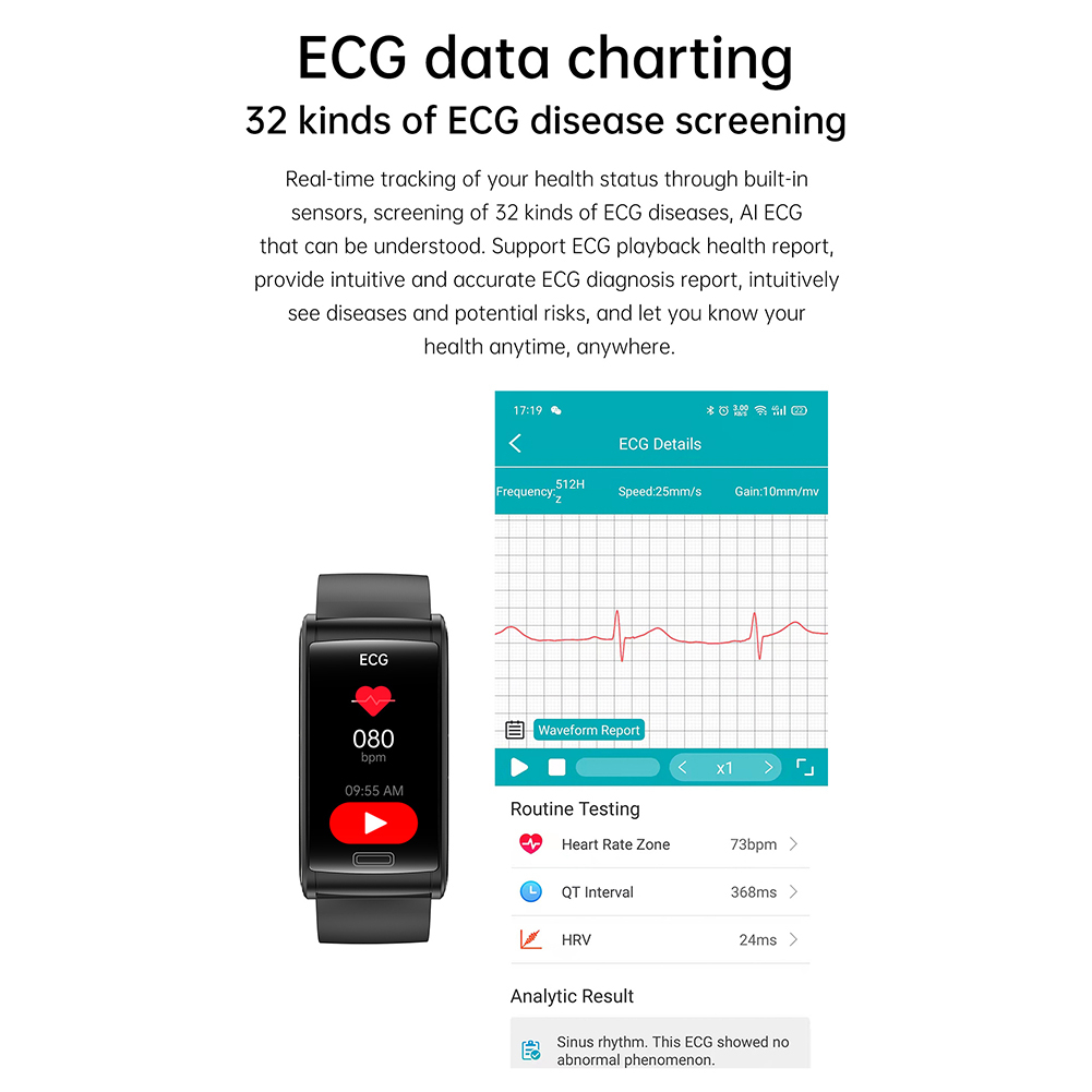Đồng Hồ Thông Minh 2023 New E600 Màn Hình Cảm Ứng ECG Theo Dõi Oxy IP68 Chống Thấm Nước