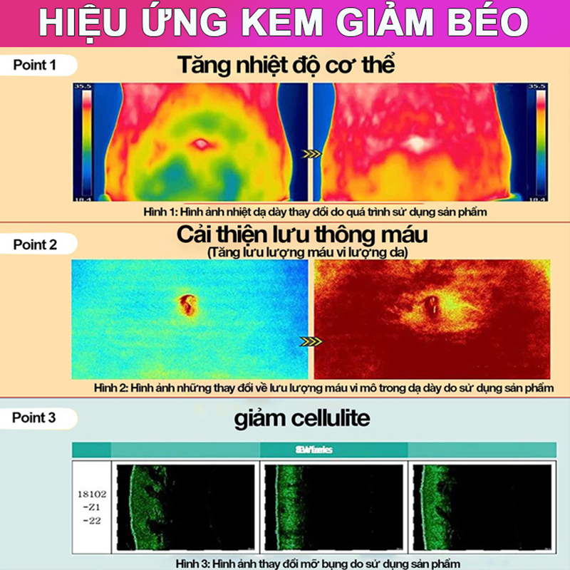 👍🏻Chính Hãng👍🏻Kem giảm cân Kem đốt mỡ, giảm mỡ nhanh, tiêu đốt khối mỡ, kem massage giảm cân, kem tiêu mỡ làm nóng dịu nhẹ 7 ngày để chứng kiến ​​kết quả tuyệt vời