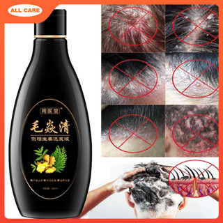  Dầu Gội Trị Gàu   Gàu   Nấm   Nấm   Nấm Da Đầu Chính Hãng Cho Nam Nữ 