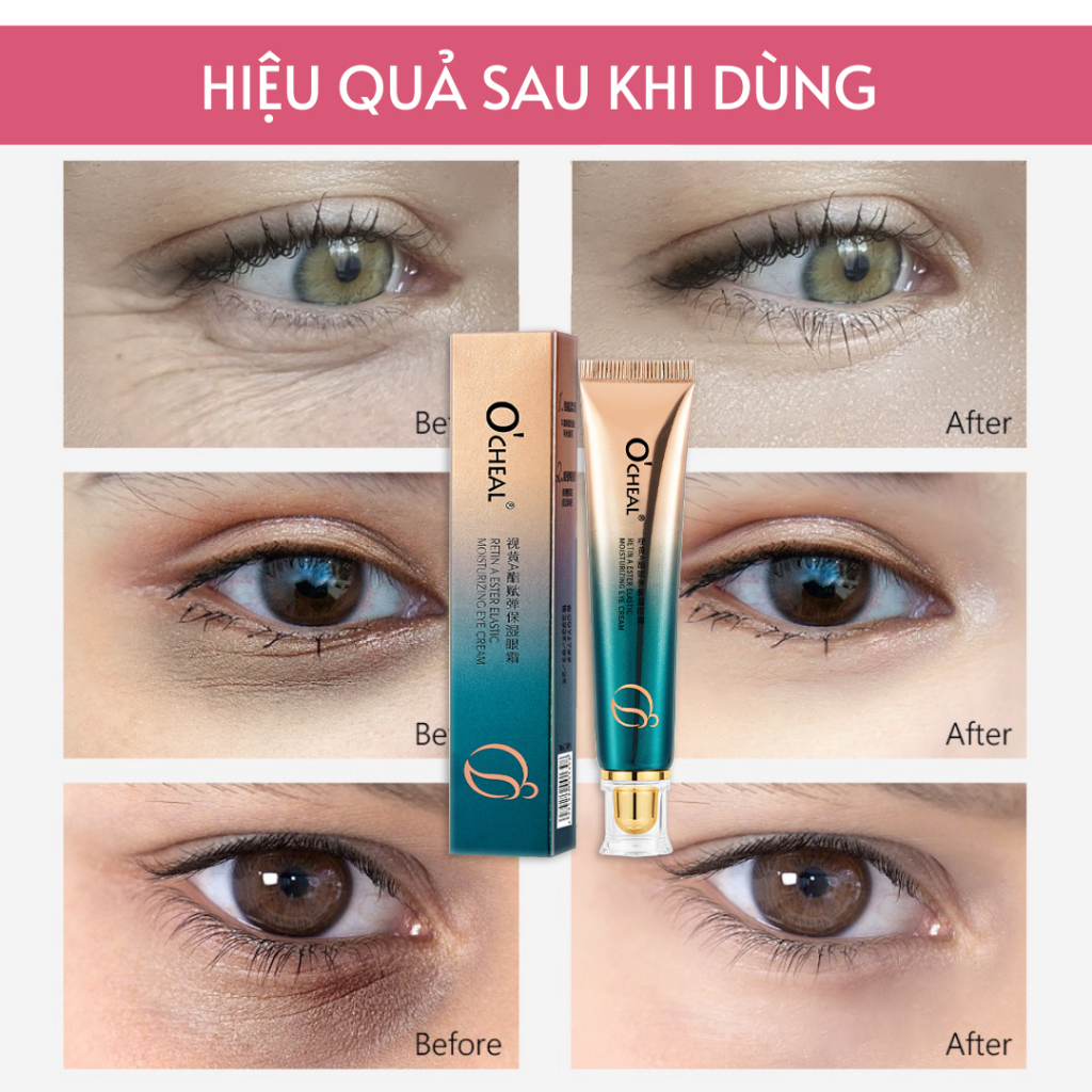👍🏻Chính Hãng👍🏻 Kem mắt Retinol A Ester Giảm Quầng Thâm Mắt , Chống Lão Hóa , Nâng Cơ Da Vùng Mắt 30g